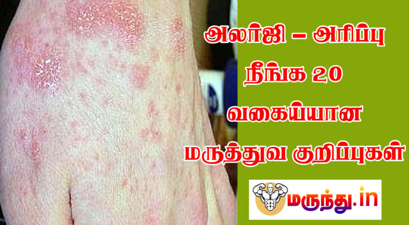 Effective Siddha Remedies for Allergy Itching Relief