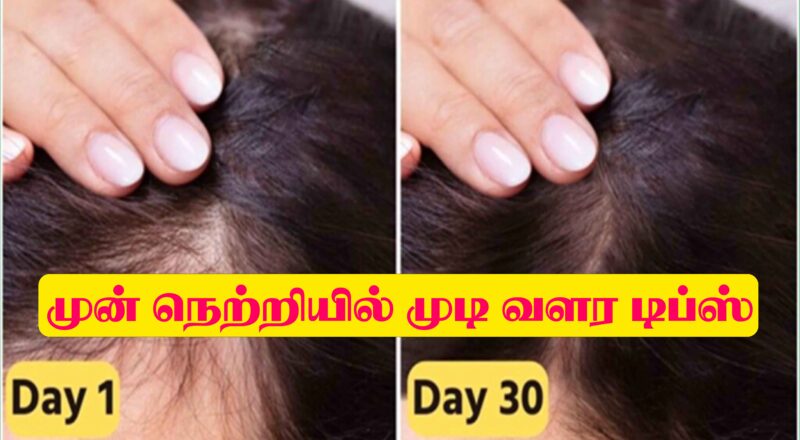 Forehead Hair Growth in Tamil